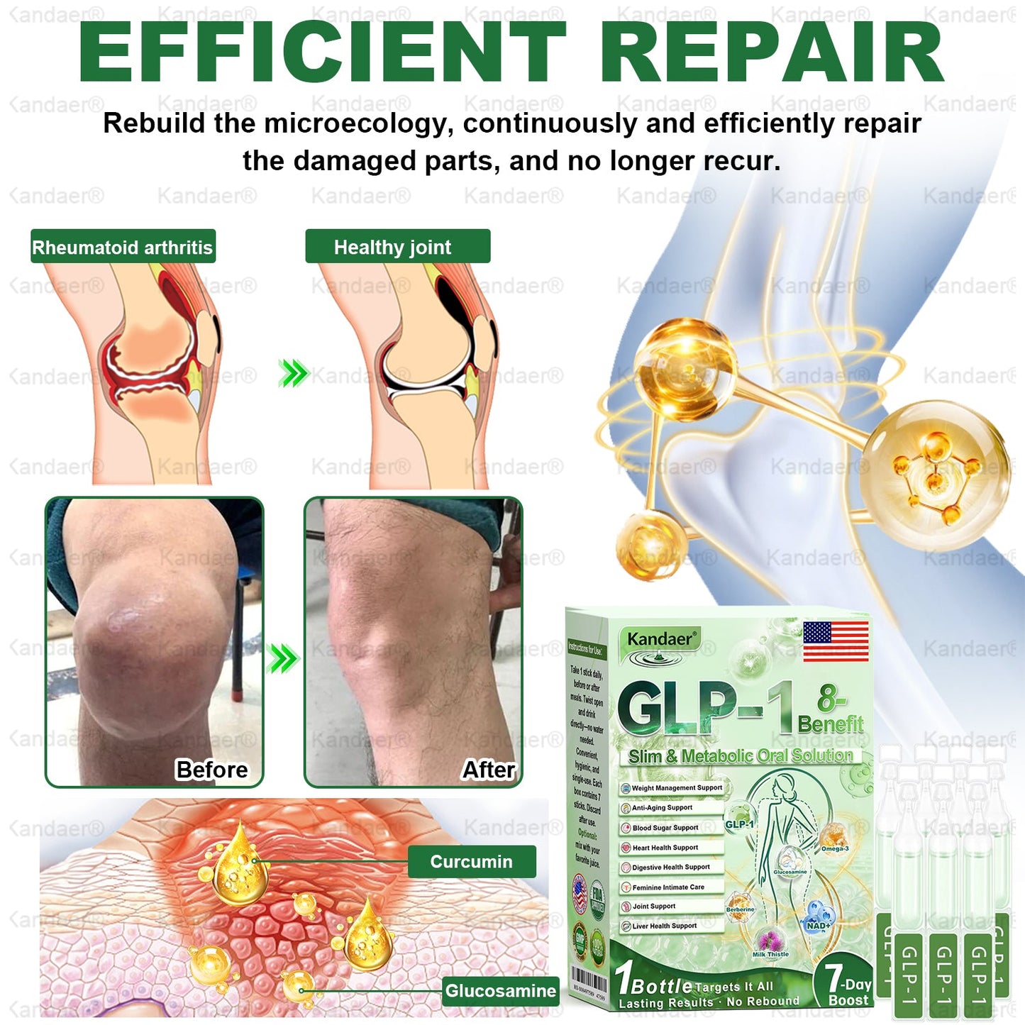 𝐊𝗮𝗻𝐝𝒂𝒆𝒓®𝑮𝗟𝑃-1 8-𝐁𝒆𝒏𝒆𝗳𝗶𝘁  𝑺𝗹𝗶𝗺 & 𝙈𝐞𝐭𝐚𝒃𝗼𝗹𝗶𝗰 𝗢𝒓𝒂𝒍 𝑺𝒐𝒍𝐮𝐭𝐢𝐨𝐧 (𝗢𝒏𝒄𝒆 𝒂 𝑫𝒂𝐲，𝒗𝐢𝐬𝐢𝐛𝐥𝐞 𝙧𝗲𝘀𝘂𝗹𝘁𝘀 𝙞𝒏 7 𝑫𝗮𝘆𝒔 ) 𝑭𝐨𝐫 𝒘𝗲𝗶𝗴𝗵𝘁 𝒄𝗼𝗻𝘁𝗿𝗼𝗹 / 𝒉𝐞𝐚𝐫𝐭 𝒉𝐞𝐚𝐥𝐭𝐡 / 𝒃𝐥𝐨𝐨𝐝 𝒔𝐮𝐠𝐚𝐫 / 𝒔𝐥𝐞𝐞𝐩 𝒒𝐮𝐚𝐥𝐢𝐭𝐲 / 𝒅𝐢𝐠𝐞𝐬𝐭𝐢𝐨𝐧 / 𝒘𝐨𝐦𝐞𝐧'𝐬 𝒄𝐨𝐦𝐟𝐨𝐫𝐭 / 𝒋𝐨𝐢𝐧𝐭 𝒎𝐨𝐛𝐢𝐥𝐢𝐭𝐲