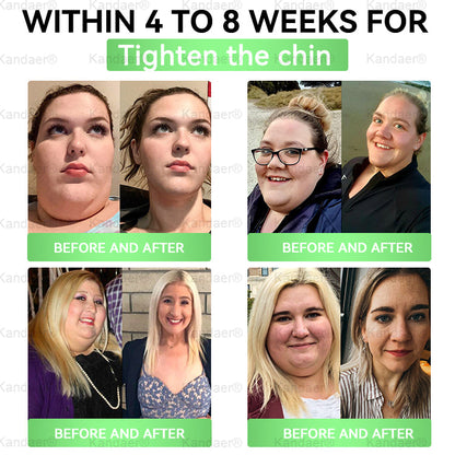 𝐊𝗮𝗻𝐝𝒂𝒆𝒓®𝑮𝗟𝑃-1 8-𝐁𝒆𝒏𝒆𝗳𝗶𝘁  𝑺𝗹𝗶𝗺 & 𝙈𝐞𝐭𝐚𝒃𝗼𝗹𝗶𝗰 𝗢𝒓𝒂𝒍 𝑺𝒐𝒍𝐮𝐭𝐢𝐨𝐧 (𝗢𝒏𝒄𝒆 𝒂 𝑫𝒂𝐲，𝒗𝐢𝐬𝐢𝐛𝐥𝐞 𝙧𝗲𝘀𝘂𝗹𝘁𝘀 𝙞𝒏 7 𝑫𝗮𝘆𝒔 ) 𝑭𝐨𝐫 𝒘𝗲𝗶𝗴𝗵𝘁 𝒄𝗼𝗻𝘁𝗿𝗼𝗹 / 𝒉𝐞𝐚𝐫𝐭 𝒉𝐞𝐚𝐥𝐭𝐡 / 𝒃𝐥𝐨𝐨𝐝 𝒔𝐮𝐠𝐚𝐫 / 𝒔𝐥𝐞𝐞𝐩 𝒒𝐮𝐚𝐥𝐢𝐭𝐲 / 𝒅𝐢𝐠𝐞𝐬𝐭𝐢𝐨𝐧 / 𝒘𝐨𝐦𝐞𝐧'𝐬 𝒄𝐨𝐦𝐟𝐨𝐫𝐭 / 𝒋𝐨𝐢𝐧𝐭 𝒎𝐨𝐛𝐢𝐥𝐢𝐭𝐲