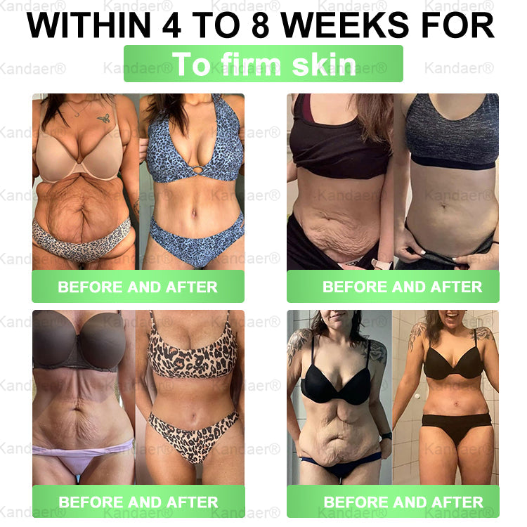 𝐊𝗮𝗻𝐝𝒂𝒆𝒓®𝑮𝗟𝑃-1 8-𝐁𝒆𝒏𝒆𝗳𝗶𝘁  𝑺𝗹𝗶𝗺 & 𝙈𝐞𝐭𝐚𝒃𝗼𝗹𝗶𝗰 𝗢𝒓𝒂𝒍 𝑺𝒐𝒍𝐮𝐭𝐢𝐨𝐧 (𝗢𝒏𝒄𝒆 𝒂 𝑫𝒂𝐲，𝒗𝐢𝐬𝐢𝐛𝐥𝐞 𝙧𝗲𝘀𝘂𝗹𝘁𝘀 𝙞𝒏 7 𝑫𝗮𝘆𝒔 ) 𝑭𝐨𝐫 𝒘𝗲𝗶𝗴𝗵𝘁 𝒄𝗼𝗻𝘁𝗿𝗼𝗹 / 𝒉𝐞𝐚𝐫𝐭 𝒉𝐞𝐚𝐥𝐭𝐡 / 𝒃𝐥𝐨𝐨𝐝 𝒔𝐮𝐠𝐚𝐫 / 𝒔𝐥𝐞𝐞𝐩 𝒒𝐮𝐚𝐥𝐢𝐭𝐲 / 𝒅𝐢𝐠𝐞𝐬𝐭𝐢𝐨𝐧 / 𝒘𝐨𝐦𝐞𝐧'𝐬 𝒄𝐨𝐦𝐟𝐨𝐫𝐭 / 𝒋𝐨𝐢𝐧𝐭 𝒎𝐨𝐛𝐢𝐥𝐢𝐭𝐲