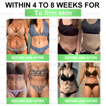 𝐊𝗮𝗻𝐝𝒂𝒆𝒓®𝑮𝗟𝑃-1 8-𝐁𝒆𝒏𝒆𝗳𝗶𝘁  𝑺𝗹𝗶𝗺 & 𝙈𝐞𝐭𝐚𝒃𝗼𝗹𝗶𝗰 𝗢𝒓𝒂𝒍 𝑺𝒐𝒍𝐮𝐭𝐢𝐨𝐧 (𝗢𝒏𝒄𝒆 𝒂 𝑫𝒂𝐲，𝒗𝐢𝐬𝐢𝐛𝐥𝐞 𝙧𝗲𝘀𝘂𝗹𝘁𝘀 𝙞𝒏 7 𝑫𝗮𝘆𝒔 ) 𝑭𝐨𝐫 𝒘𝗲𝗶𝗴𝗵𝘁 𝒄𝗼𝗻𝘁𝗿𝗼𝗹 / 𝒉𝐞𝐚𝐫𝐭 𝒉𝐞𝐚𝐥𝐭𝐡 / 𝒃𝐥𝐨𝐨𝐝 𝒔𝐮𝐠𝐚𝐫 / 𝒔𝐥𝐞𝐞𝐩 𝒒𝐮𝐚𝐥𝐢𝐭𝐲 / 𝒅𝐢𝐠𝐞𝐬𝐭𝐢𝐨𝐧 / 𝒘𝐨𝐦𝐞𝐧'𝐬 𝒄𝐨𝐦𝐟𝐨𝐫𝐭 / 𝒋𝐨𝐢𝐧𝐭 𝒎𝐨𝐛𝐢𝐥𝐢𝐭𝐲